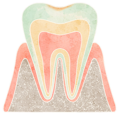 C0（虫歯の初期段階）